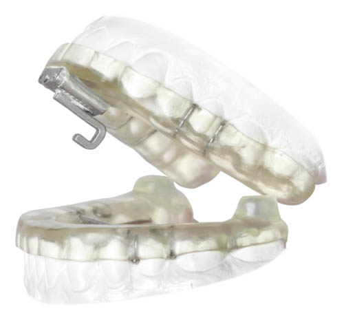 A clear plastic dental retainer with two metal clasps, displayed against a white background.