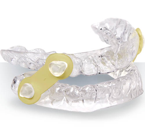 The image displays a set of clear plastic dental retainers with yellow clasps and a small, round, yellow object attached to one of them, placed on a transparent surface against a white background.
