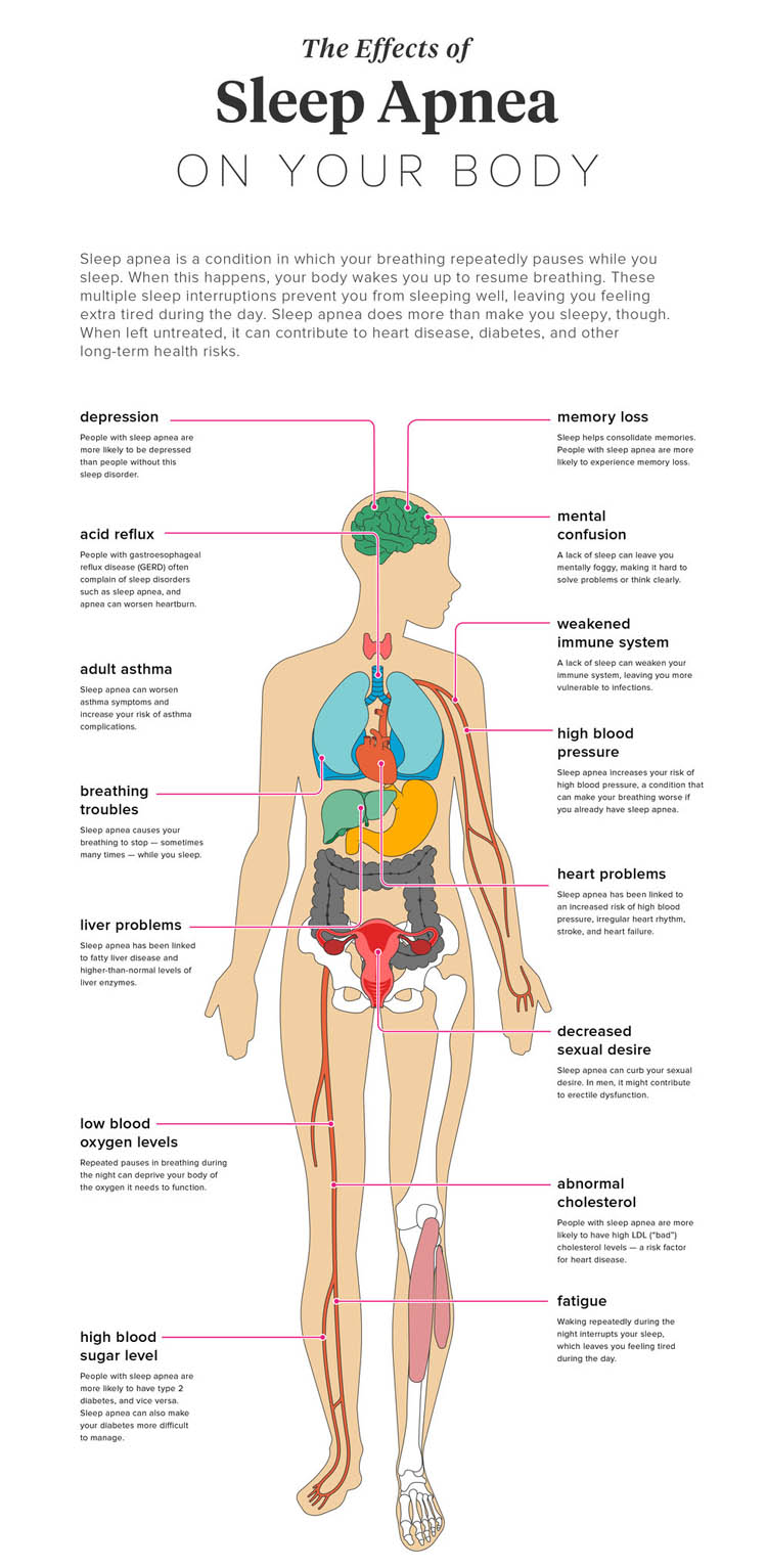 The image displays a detailed illustration of the human body with labels indicating various anatomical parts, accompanied by text explaining the effects of sleep apnea on the body.